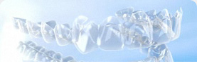 What is Invisalign G3?